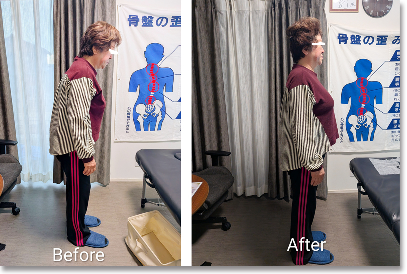 腰痛が改善することで自然と真っ直ぐ立てるように